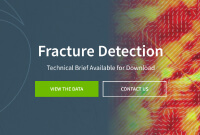 Fracture Detection